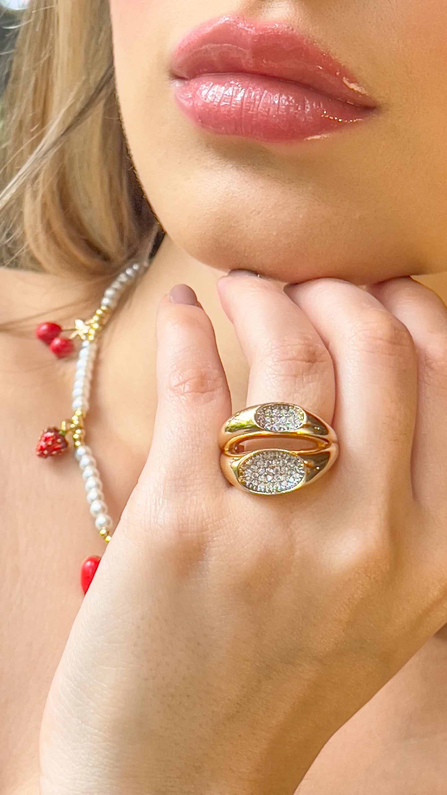 Anillo Buckets